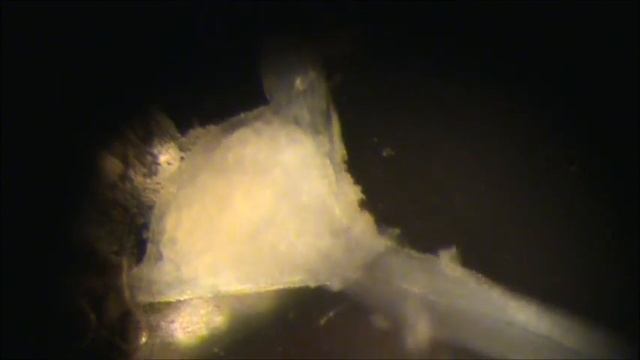 leech culture part 1 смотреть онлайн