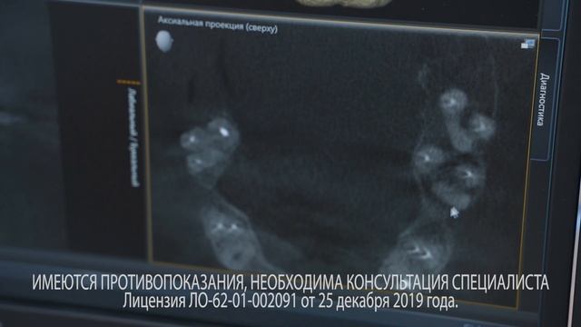 Центр дентальной диагностики ПРАЙМ смотреть онлайн
