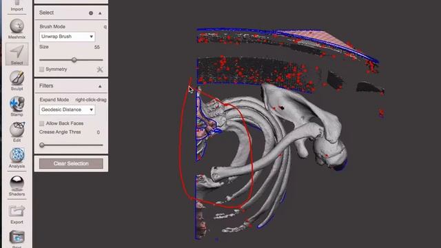 Transform CT into 3D model and measure смотреть онлайн