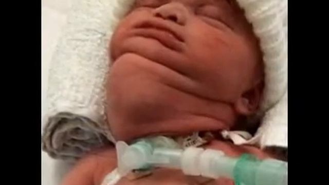 Skin-crawling video shows hundreds of PUBIC LICE living in six-year-old boy' смотреть онлайн