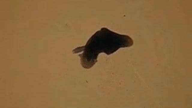 Planaria vs. Aleve смотреть онлайн