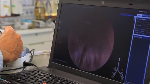 Dr Paul Baker discusses the ORSIM Bronchoscopy Simulator смотреть онлайн