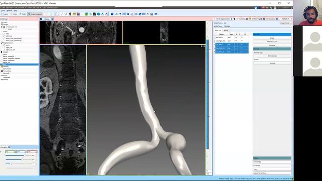 SimVascular Tutorial 5: Model Building смотреть онлайн