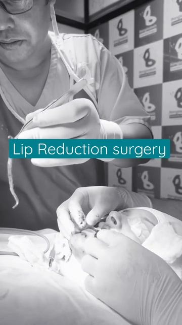 Lip reduction | Lip reduction surgery in Bangladesh | Lip surgery | Dr Iqbal Ahmed смотреть онлайн