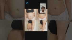 Как поднять внутренние органы/ Как убрать живот/ Как худеть правильно - Ответы на вопросы в ПЭ