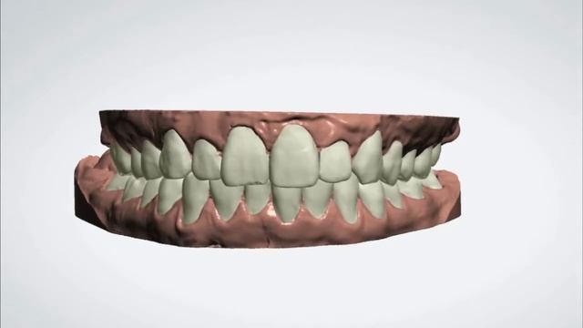 3D выравнивание смотреть онлайн