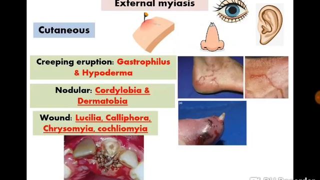 3 Flies & Myiasis - Dr Noha Madbouly смотреть онлайн