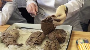 Анатомия сердца. Строение. Круги кровообращения