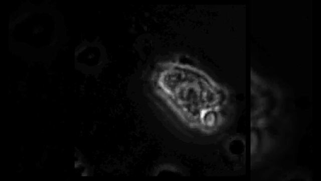 A macrophage sends out pseudopodia to engulf a fungal spore смотреть онлайн