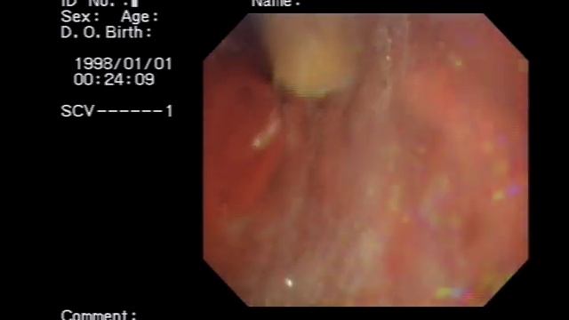 Inside stomach vore смотреть онлайн