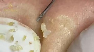 Relax Every Day With Loan Nguyen Spa TV #1045