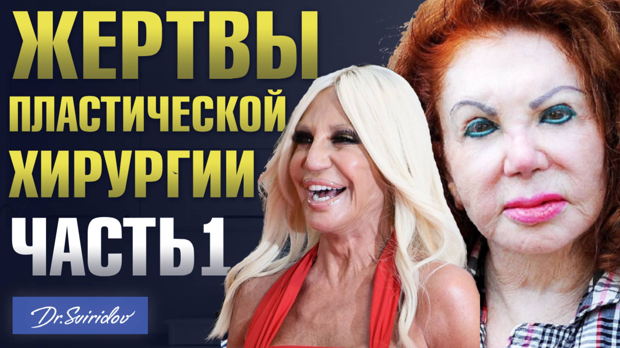 Жертвы пластической хирургии | Неудачная пластика звезд | ЧАСТЬ 1 смотреть онлайн