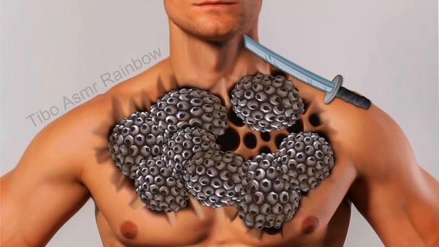 ASMR Remove Maggot & Worm Infected body chest Deep Cleaning Animation Treatment @tibo asmr смотреть онлайн