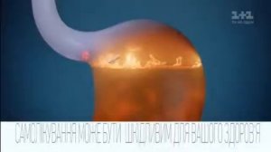 Реклама лекарств Gaviscon (1+1, Февраль 2017)