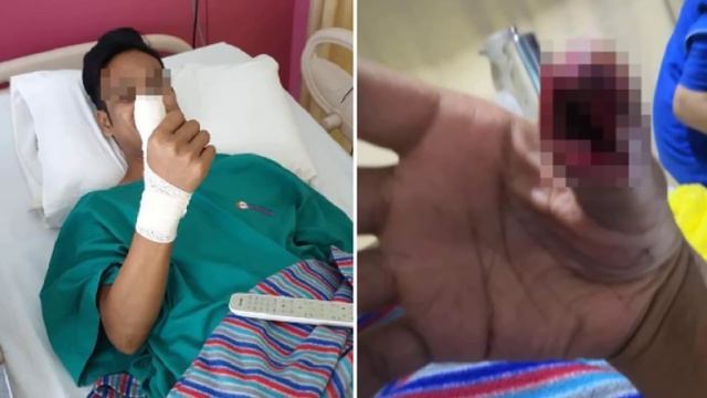 పిసినారి తనం వద్దు ఆలోచించండి 😱|| Cracked screen protector Very danger Telugu смотреть онлайн