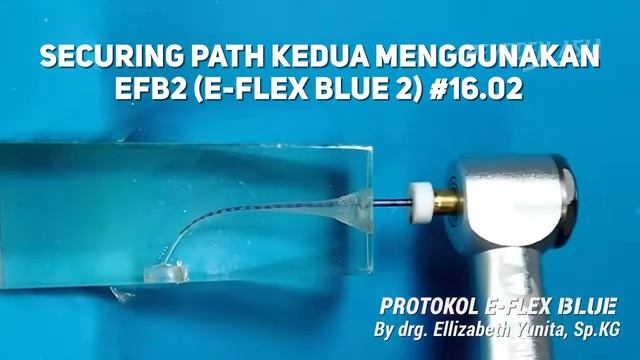 ‼️EIGHTEETH'S E-FLEX BLUE FILES TUTORIAL ON ENDOBLOCK‼️ смотреть онлайн