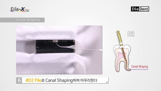 DiaDent Endodontic Treatment смотреть онлайн
