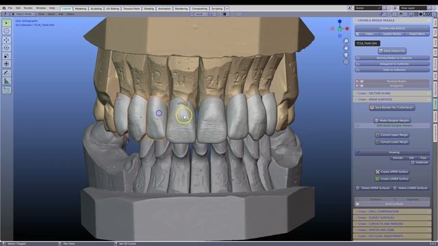 B4D Dental Modules смотреть онлайн