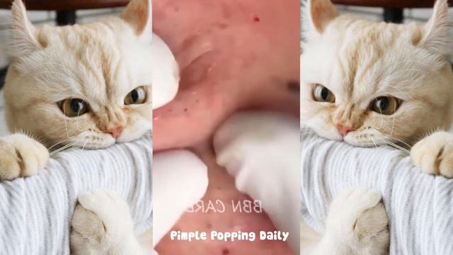 #220. Remove super pimple I Dr. Daily смотреть онлайн