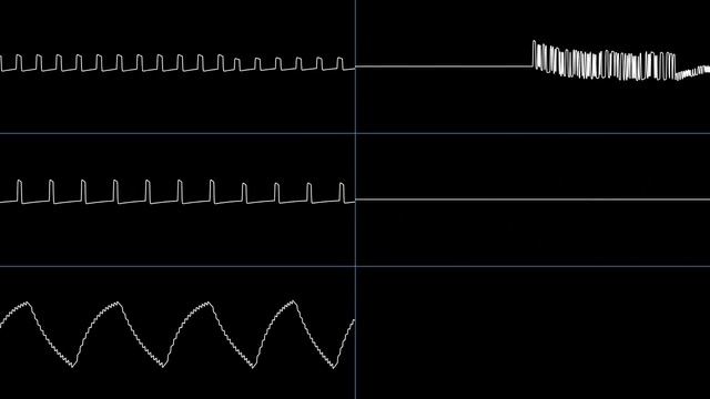 Arumana no Kiseki - Stage 1 (US remake) [2A03] (Oscilloscope View) смотреть онлайн