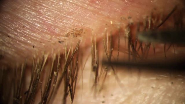 Mascara, Mucus, Demodex Removal смотреть онлайн