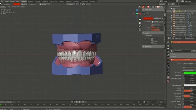 Digital Denture for 3D Printing смотреть онлайн