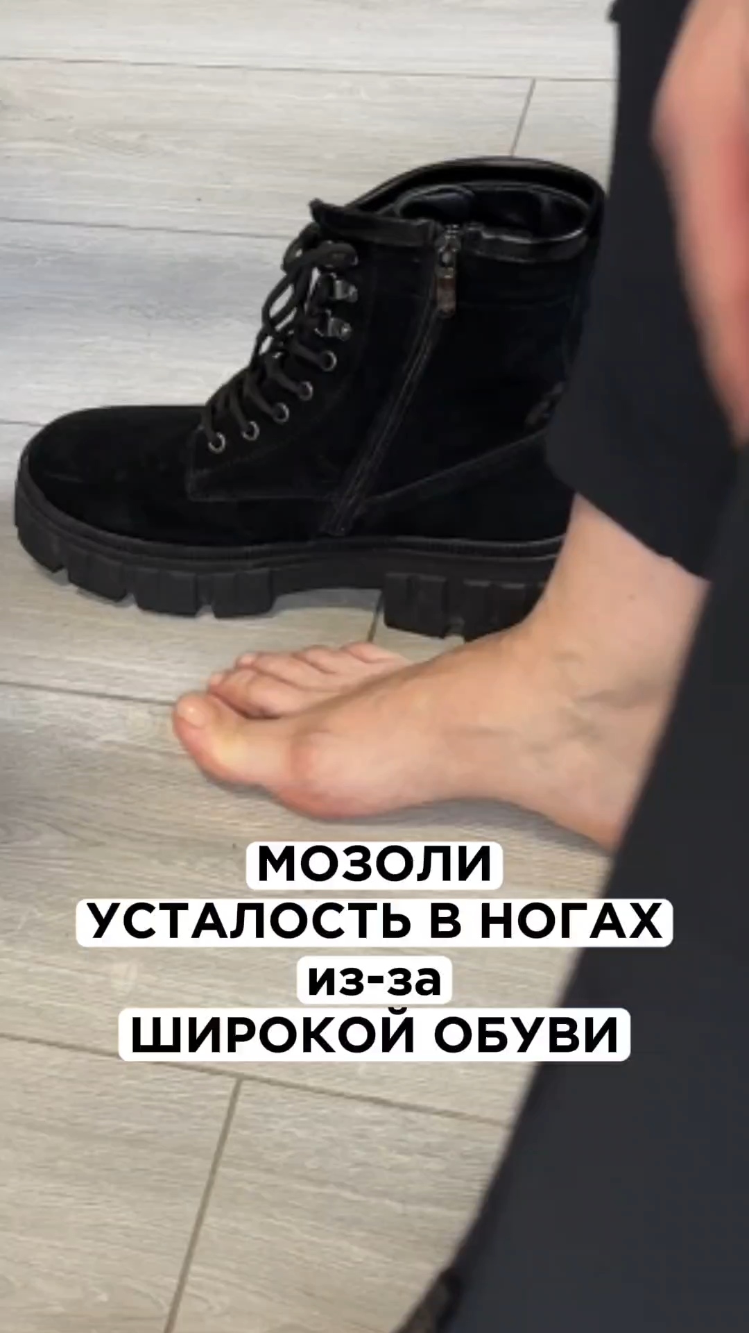 Мозоли, натёртости на стопе появляются из-за широкой обуви #плоскостопие #мозоли #стельки смотреть онлайн
