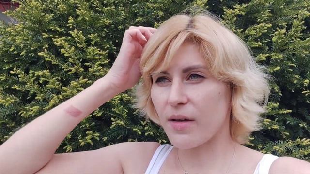 Я жива ☺️ #онкобудни #онкобудни #рмж #лечениерака