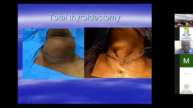 Virtual CME- Head and neck 2021-ENT Day-1 смотреть онлайн