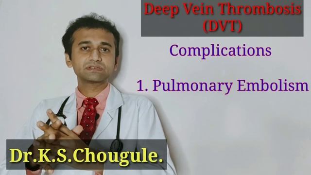 DVT क्यू होता है? सही ईलाज क्या है? Everything about deep vein thrombosis explained! हिंदी मे । смотреть онлайн