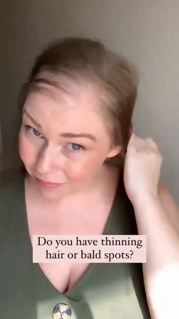 Средство против облысения и алопеции смотреть онлайн