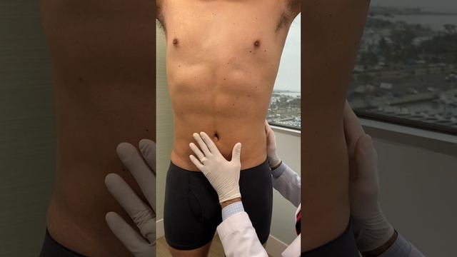HOW TO GET "6-Pack" ABS | 360 Liposuction | 2 Months Post-op смотреть онлайн