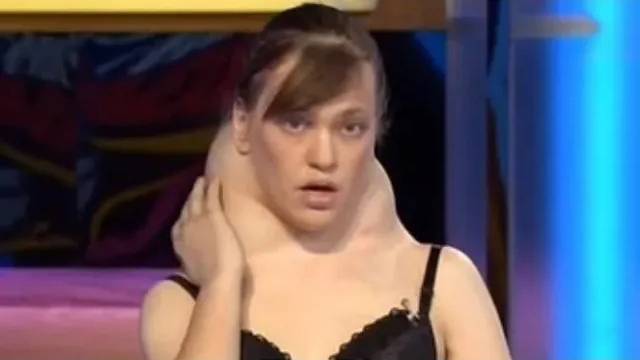 Что случилось с девушкой имеющую ужасные опухоли, героиня Говорим и показываем - "Что за напасть? смотреть онлайн