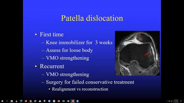 Knee Anatomy - Charles Gatt, MD смотреть онлайн