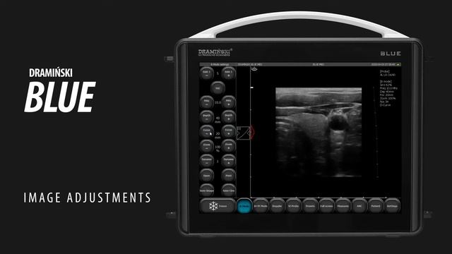 Part 2. How to adjust the image parameters. DRAMIŃSKI BLUE portable ultrasound scanner. смотреть онлайн