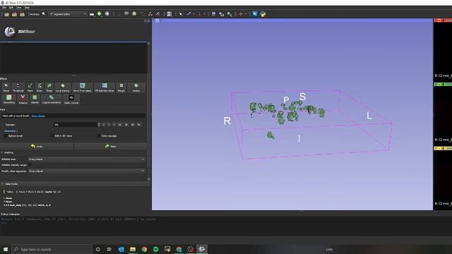 3D Volume Annotations Tutorial Using IMageJ and 3D Slicer смотреть онлайн
