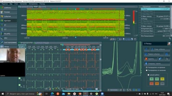 02_BTL CardioPoint Холтер