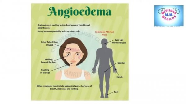 Ramipril 5mg tablets| ramipril tablets ip 2.5 mg in hindi | ramipril tablet | medishanmedicos