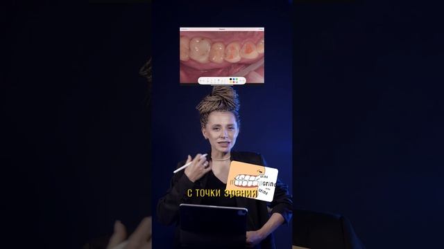 Классные, ровные зубы и проблема