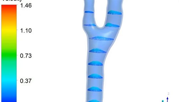 Thesis FSI Carotid - Velocity vectors - ANSYS vel vector смотреть онлайн