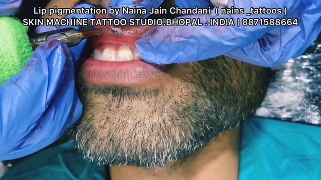 Vitiligo lip pigmentations | 90% success results by Skin Machine Tattoo | Naina Jain Chandani смотреть онлайн