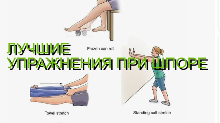 ЛУЧШИЕ УПРАЖНЕНИЯ ПРИ ПЯТОЧНОЙ ШПОРЕ смотреть онлайн
