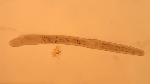 Microscopic Network Society: Unseen: Stenostomum: Anaconda смотреть онлайн