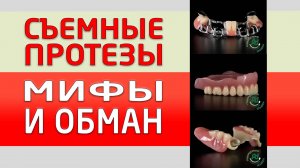 Что только не говорят про съемные протезы, какие только отзывы не пишут! Это просто мифы или обман?