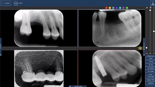 Обзор Deep View - программное обеспечение для рентгеновского оборудования