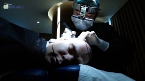 Пересадка волос на голове. Операция по пересадке волос. Миноксидил и выпадение волос.