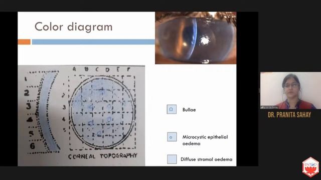 PG EXAMINATION FORUM WEBINAR on How to Crack OSCE & Practical Examination I 30th June 2020 смотреть онлайн