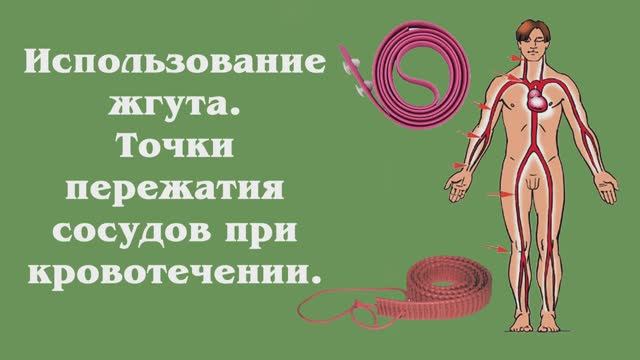 Остановка кровотечения. Важные точки и интересные методы.