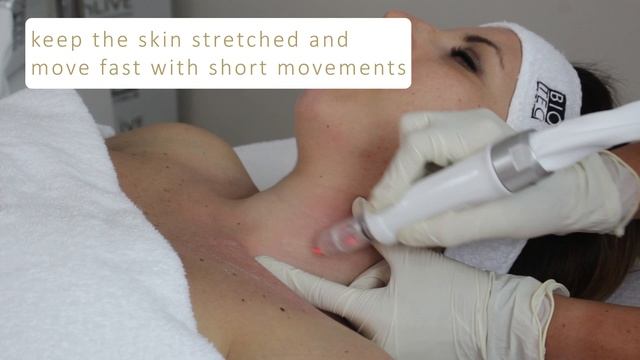 Tutorial ABRALASE Laser Peel RENOVA - Face Treatment