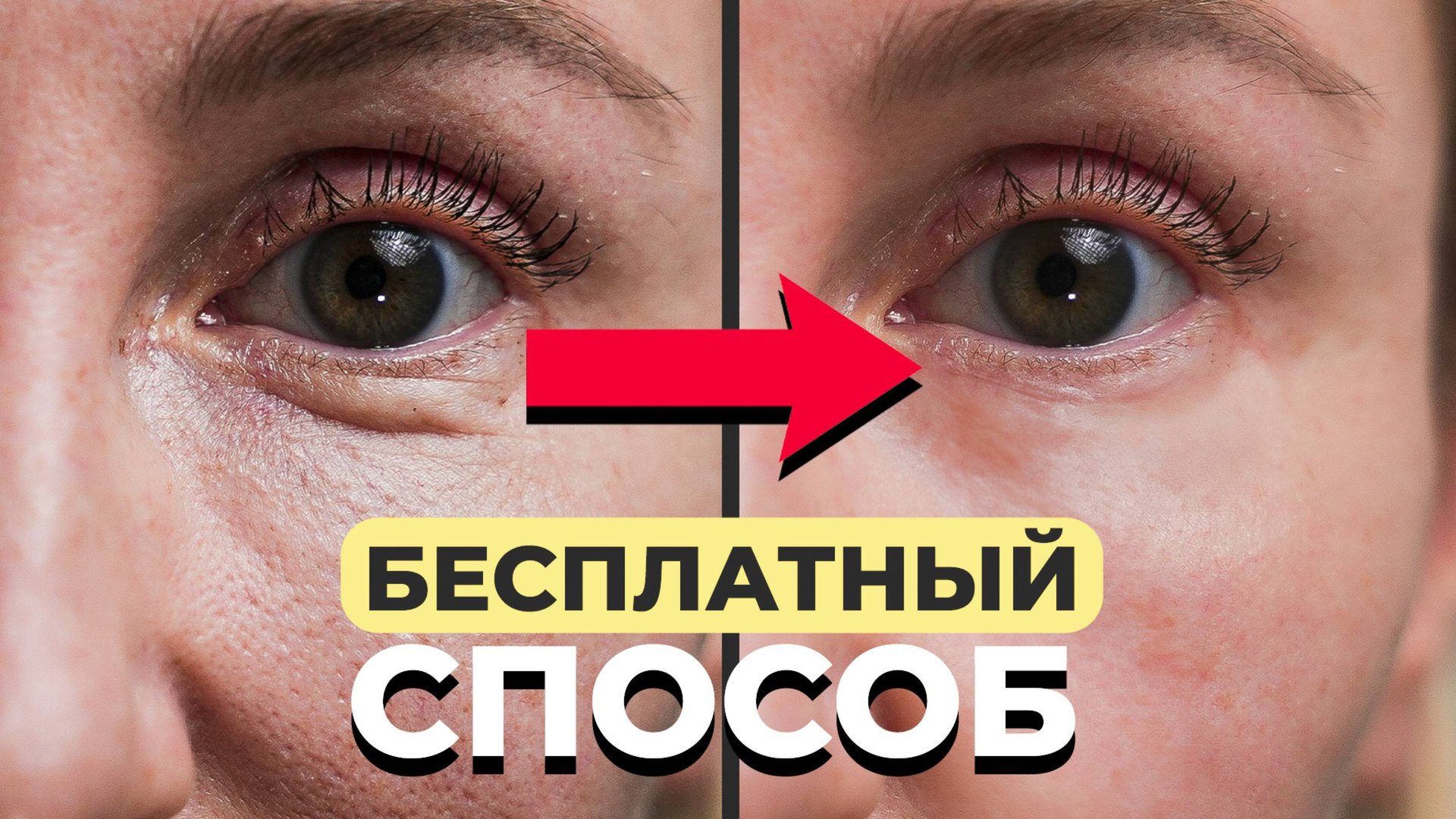 5 бесплатных способов омоложения КОЖИ ВОКРУГ ГЛАЗ. Избавляемся от МОРЩИН У ГЛАЗ